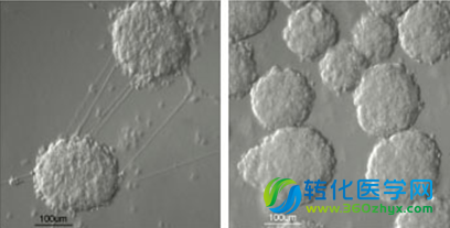 科学家成功将人类皮肤细胞重编程为胰岛素分泌细胞