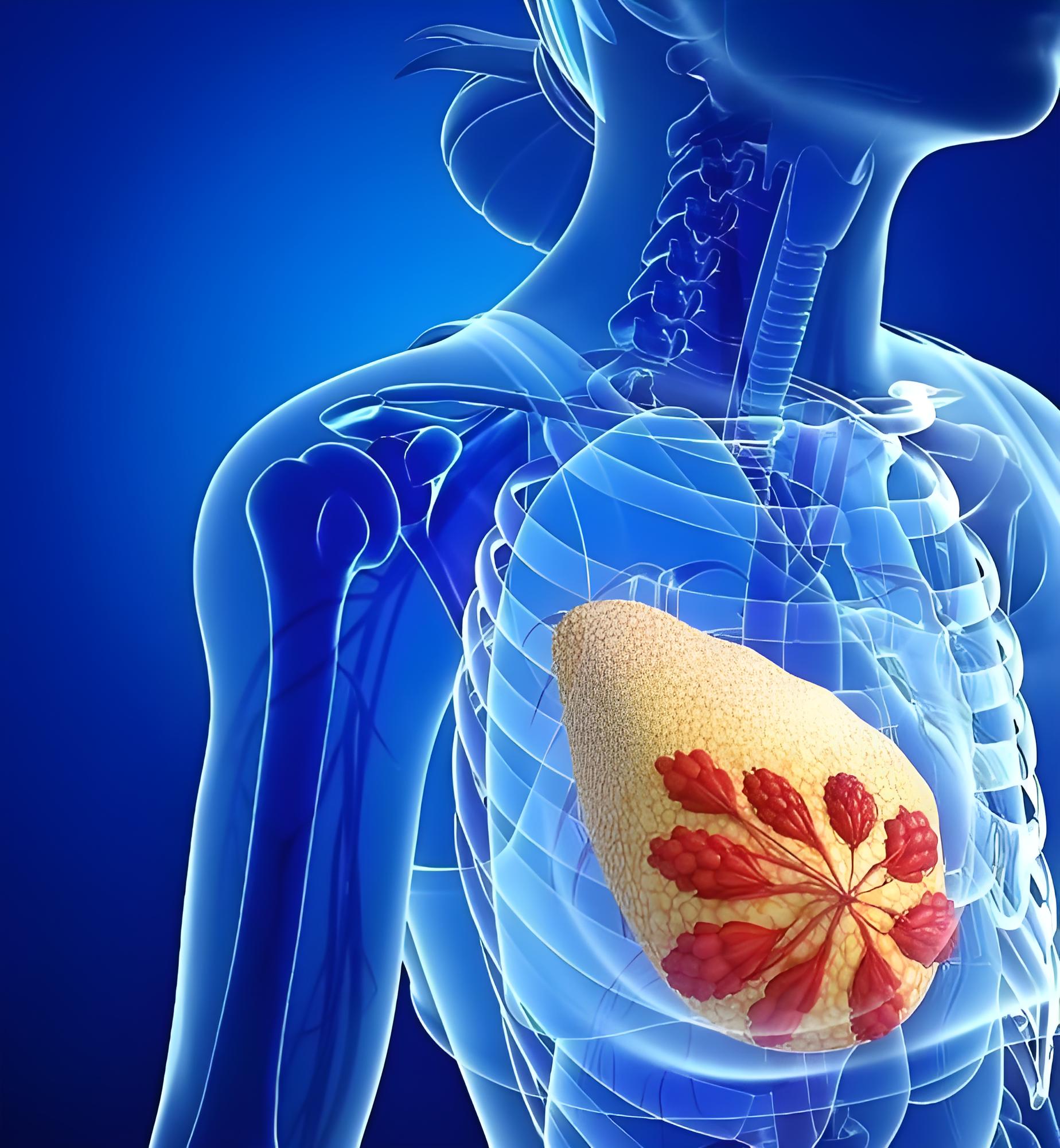 “最毒乳腺癌”治疗新突破：首都医科大学团队提出个性化治疗干预策略