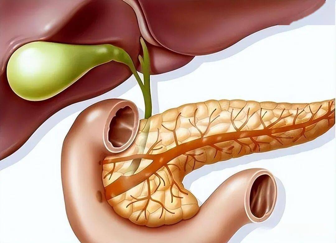 代谢靶向！中国医科大学等单位合作发文：克服胰腺癌治疗耐药性的纳米技术策略