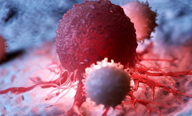 靶向分泌自噬！南京市口腔医院：治疗侵袭性口腔鳞癌有前景的策略